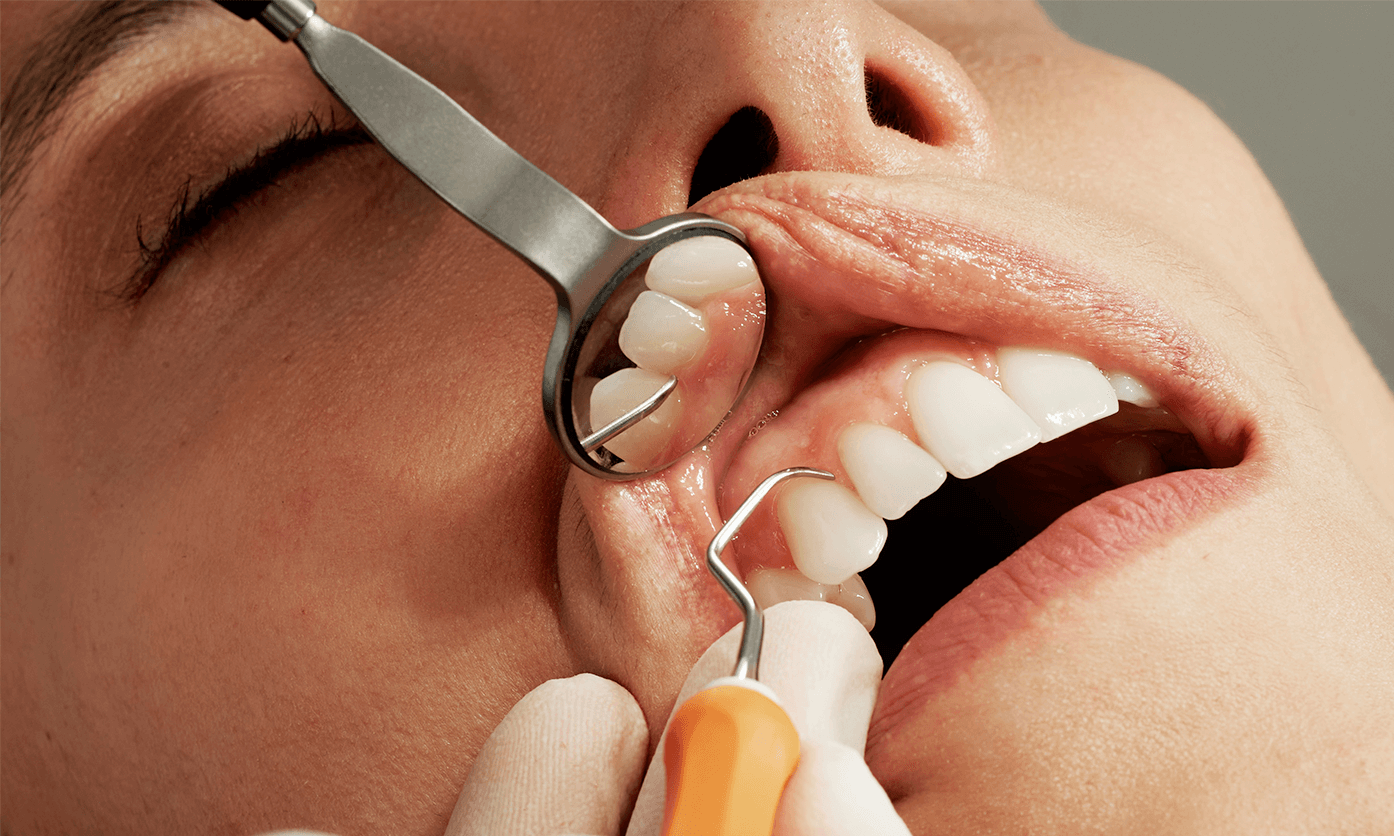 Basunders&ouml;kning