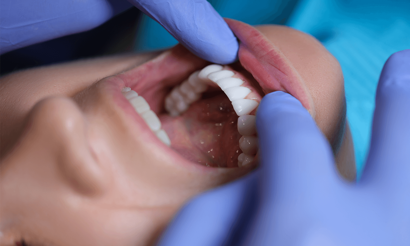 Vanliga myter om tandv&aring;rd